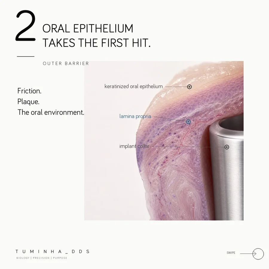 A carousel slide on peri-implant mucosa, titled Oral epithelium takes the first hit, with labels for the keratinized oral epithelium, the lamina propria and the implant collar.